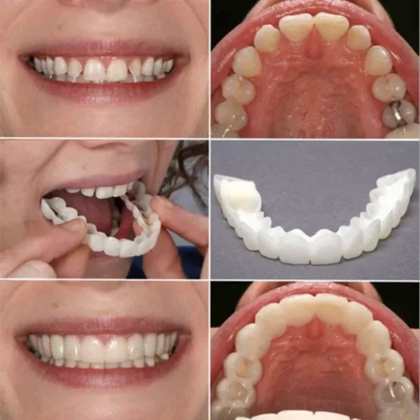 Smile teeth Silicone Imitation Braces - Image 2